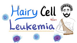 Hairy Cell Leukemia HCL  Bcell Neoplasm  TRAP   Cladribine Therapy  Hematology and Oncology [upl. by Milena]