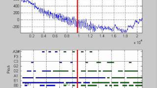 EMDsonic EEG sonifcation using EMD amp HHT signal processing approach [upl. by Gnak559]