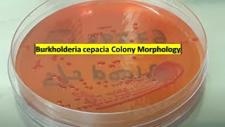 Burkholderia cepacia growth on Macconkey agar [upl. by Debarath]