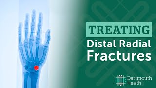 Treating Distal Radius Fractures at Dartmouth Health [upl. by Alroi]