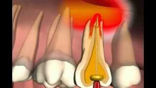 Paranasal Sinuses [upl. by Ecnedac]