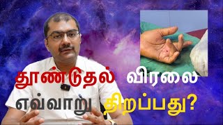 What is the treatment of choice for trigger finger Dr Soundar I Tamil [upl. by Ahseinar]