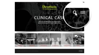 Dentium Clinical Case Server [upl. by Retnyw872]