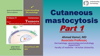 Cutaneous Mastocytosis Part 1 [upl. by Aran]