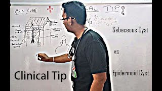 Clinical Pearl  Epidermoid vs Sebaceous Cyst Pathophysiology [upl. by Intisar]