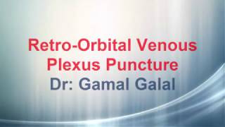 Retro Orbital Venous Plexus Puncture [upl. by Antoine]