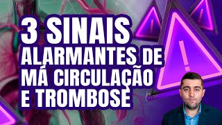 3 SINAIS DE ALERTA do risco iminente de ter má circulação ou TROMBOSE Você sente algum deles [upl. by Benson]