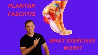 PLANTAR FASCIITIS WHAT WORKS [upl. by Teiluj350]