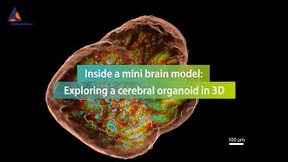 Inside a mini brain model Exploring a cerebral organoid in 3D [upl. by Anahpos296]