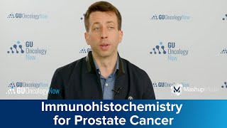 PEACE1 Identifying Prognostic and Predictive Biomarkers for SOC Treatment of mCSPC [upl. by Ardnohsed]