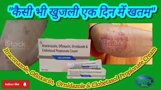 🔥Itraconazole Ofloxacin Ornidazole amp Clobetasol Propionate Cream। दादखाज और खुजली एक में खतम 100 [upl. by Bridget]