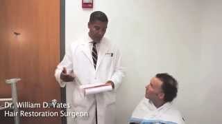 FUE Hair Transplant Patient Consultation [upl. by Yenoh]