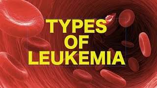 Leukemia  USMLE [upl. by Magan]