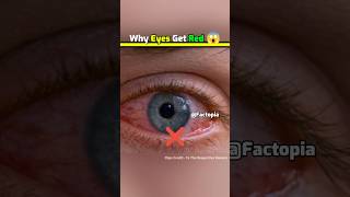 Why Eyes Get Red In Pool 😱 shorts fact factoholic eyes amazingfacts [upl. by Euqinor]