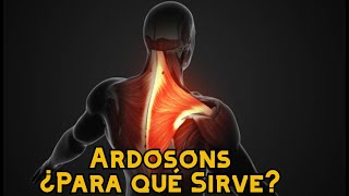 Ardosons ¿Para qué Sirve [upl. by Enrak]