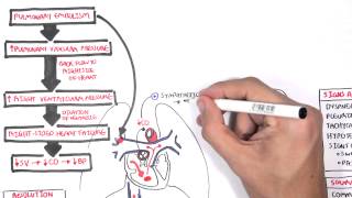 Pulmonary Embolism PART I Overview [upl. by Allenod279]