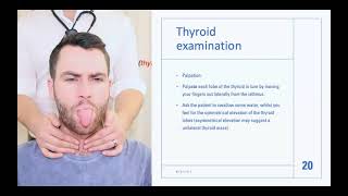 Thyroid Examination 1st part [upl. by Costello]