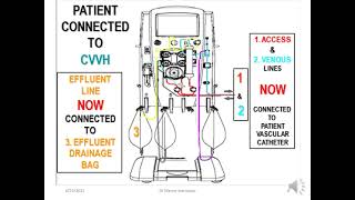 Dr Manny Learnshop CRRT Part 3 Overview the Primaflex therapy unit [upl. by Nwahsauq897]