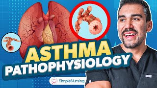 Asthma Symptoms Treatments Diagnostics Nursing  Peak Expiratory Flow Rate [upl. by Nilatak]