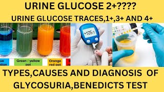 GLUCOSE SUGAR IN THE URINEBENEDICTS TESTGLUCOSE OXIDASE REAGENT STRIPSGLUCOSE 1GLUCOSE TRACES [upl. by Dusty]