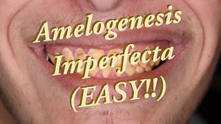 Amelogenesis Imperfecta SIMPLIFIED [upl. by Audres721]