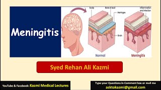 Meningitis  Neurology  Pediatric Review  KML [upl. by Richart564]