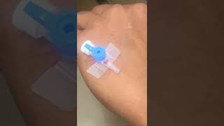 IV cannula insertiondocternursingtrendingforyouyoutubelovepopularviralvideoshortvideo [upl. by Dira]