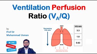 Ventilation Perfusion Ratio  VQ Ratio  VQ mismatch  Physiology of Respiration [upl. by Ariat606]