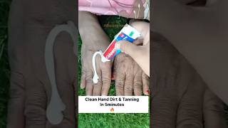 ✅️Clean Hand Dirt amp Tanning In 5minute  Hand Whitening Tipsshorts skincare beauty ytshorts🔥 [upl. by Llemij]