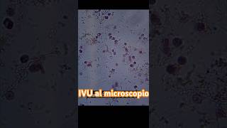 Así se ve una muestra de orina cuando hay INFECCIÓN laboratorioclinico uroanalisis short [upl. by Aryam]