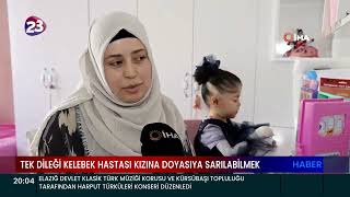 TEK DÄ°LEÄÄ° KELEBEK HASTASI KIZINA DOYASIYA SARILABÄ°LMEK [upl. by Vahe]