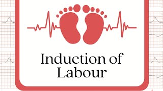 Hospital Training  Gynecology  Induction of Labour Dr Noor AlHamza 20242025 [upl. by Oderfla66]