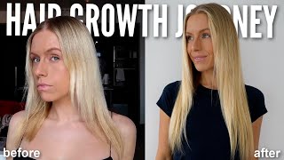 My 3 Year HAIR LOSS to HAIR GROWTH Journey My NEW Routine amp Results 2023 [upl. by Acilegna]