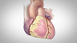 Coronary Artery Bypass Surgery [upl. by Ignacius378]