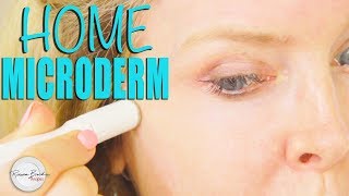 How to do Microdermabrasion at Home DIY [upl. by Alyat]