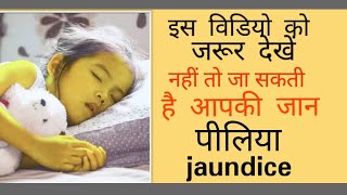 Jaundice kaise hota hai  पीलिया के symptoms [upl. by Ennayoj]