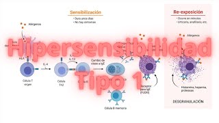 Hipersensibilidad tipo 1 explicada [upl. by Elfreda156]