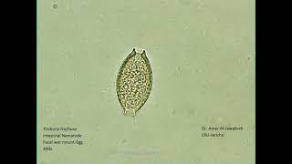 Trichuris trichiura Intestinal Nematode egg [upl. by Ausoj]