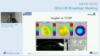 Prof Thomas Kohnen Pentacam® AXL [upl. by Peery733]
