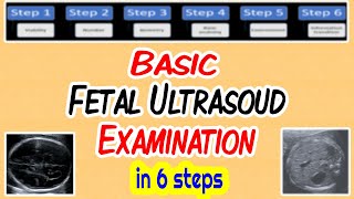 Basic Fetal Ultrasound Examination [upl. by Tina]