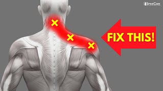 How to INSTANTLY Fix Pinched Nerve Pain in the Neck and Shoulders [upl. by Keyte675]