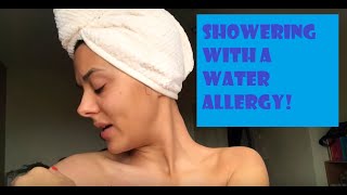 What’s it like to shower with a water allergy [upl. by Lanford994]