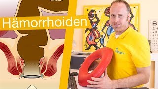 Hämorrhoiden ⚡️ Erkennen Behandeln amp Hilfsmittel [upl. by Bettye]