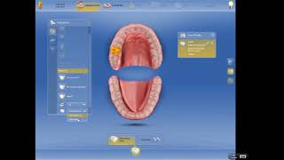 CEREC Dental Assistant Training  Basic Setup for CrownBridge [upl. by Hemphill964]