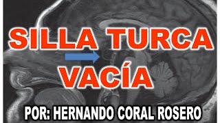 SILLA TURCA VACÍA  AFECCIÓN EN LA HIPÓFISIS [upl. by Eyllib]