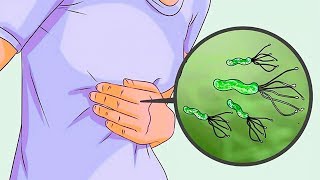 6 Proven Natural Remedies for H Pylori [upl. by Ahsiadal558]