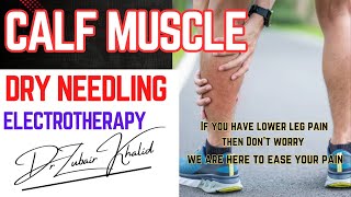 Dry Needling Gastrocnemius  Lower leg pain management Shahid ortho amp Rehab center Trigger points [upl. by Whitby319]