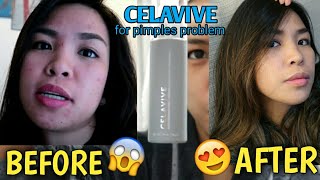 My first Skincare Routine using USANA Celavive for 60days Goodbye AcnePimples [upl. by Ettesel]