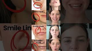 Face exercises to reduce face fat  get toned face with simple exercises shapeup [upl. by Ahsiadal137]