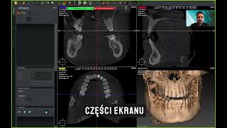 CBCT krok po kroku  od endodoncji po implanty  szkolenie Akademii 3Z [upl. by Phi834]